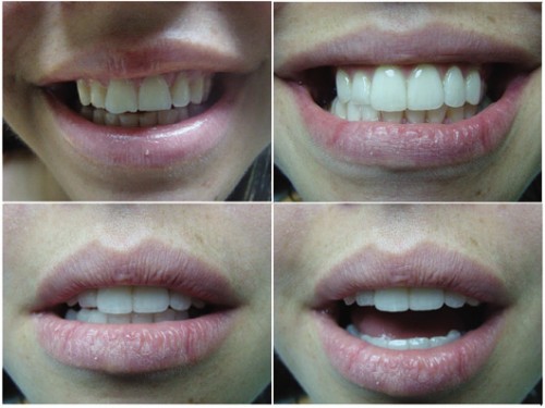 מה עושים כדי לחזור לחייך? | צילום: יח"צ 