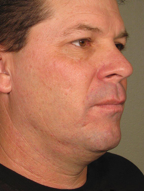 לפני הטיפול. צילום: יח"צ