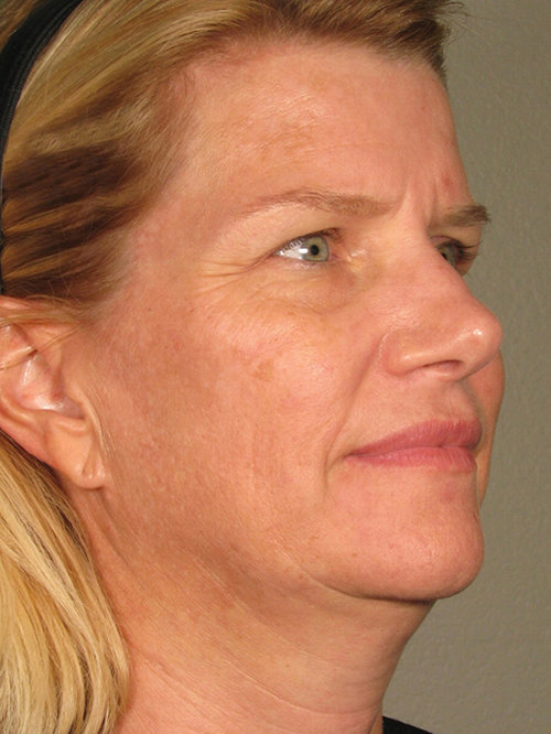 לפני הטיפול. צילום: יח"צ